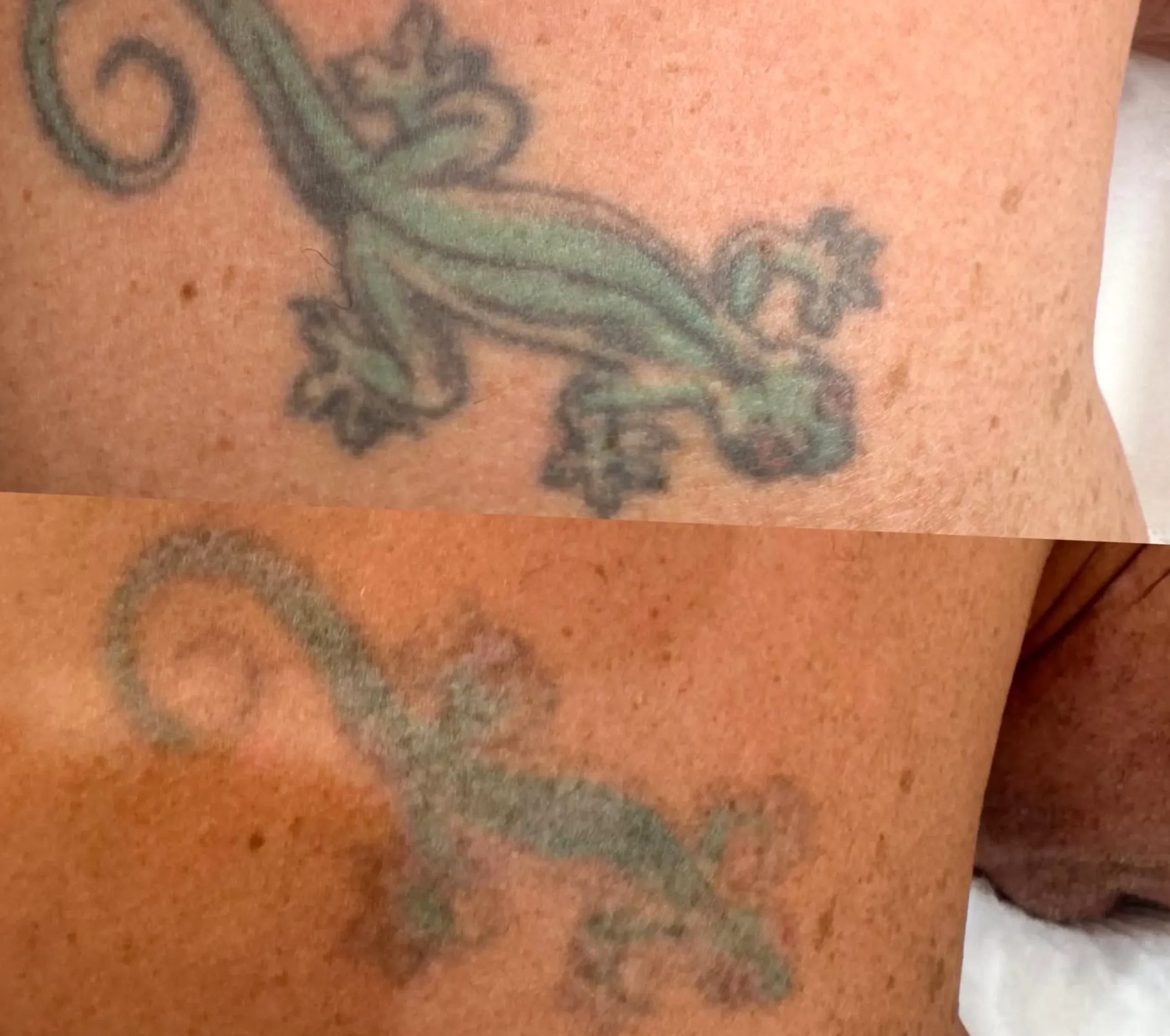 tattoo fading prevention