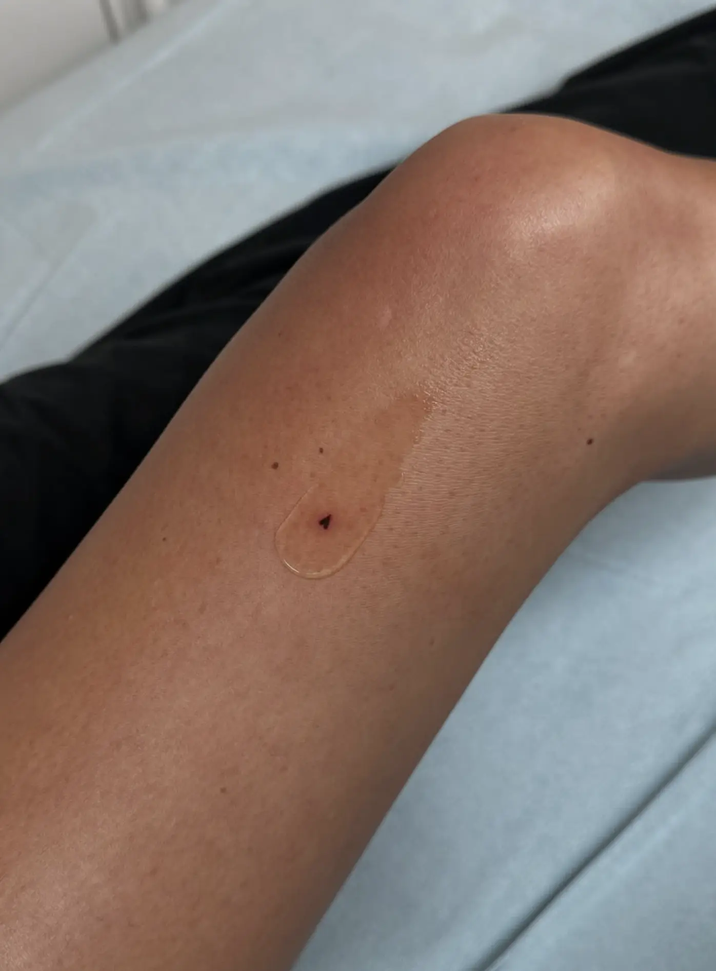 single needle tattoo Melbourne