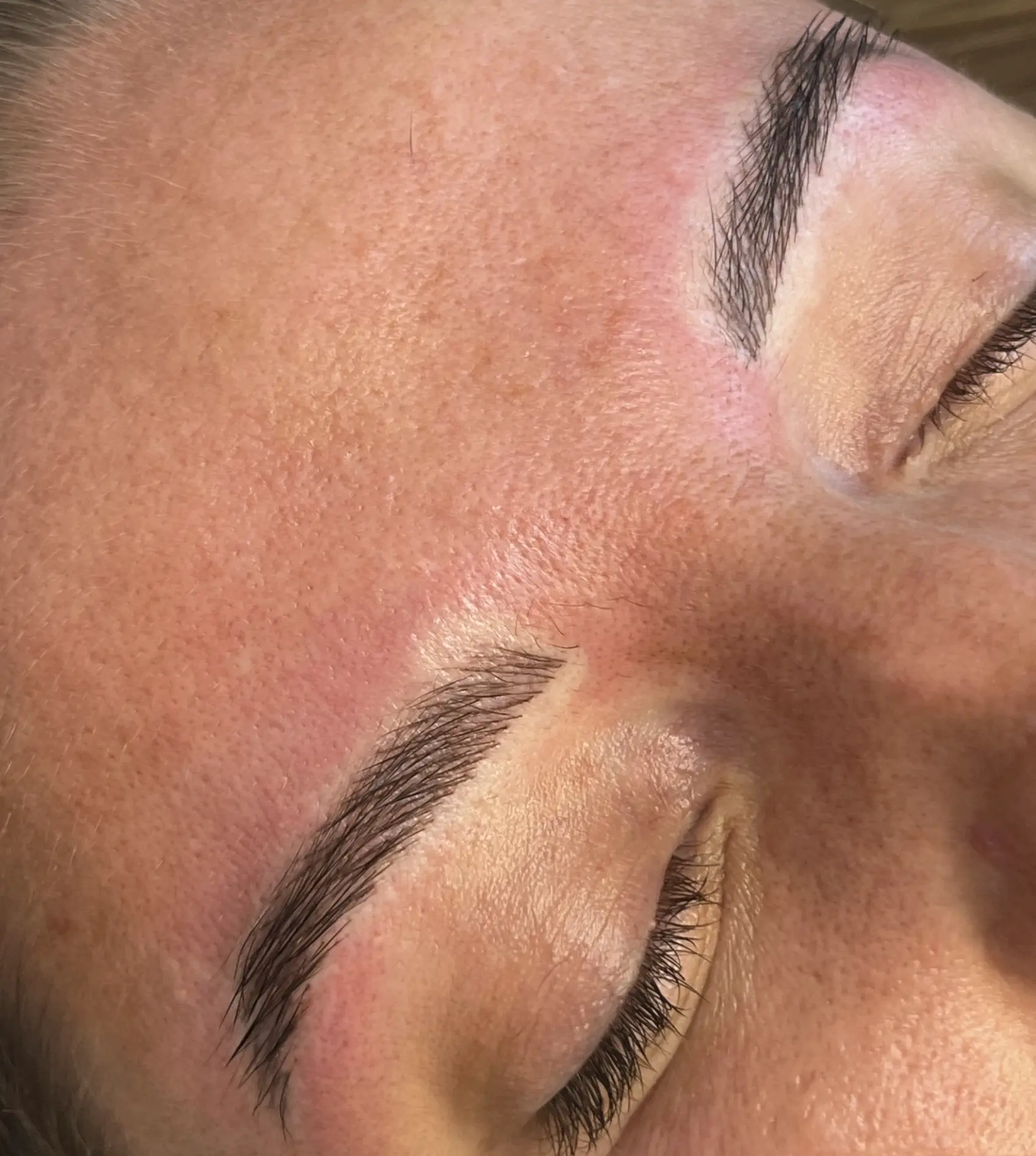eyebrow tattoo removal cost