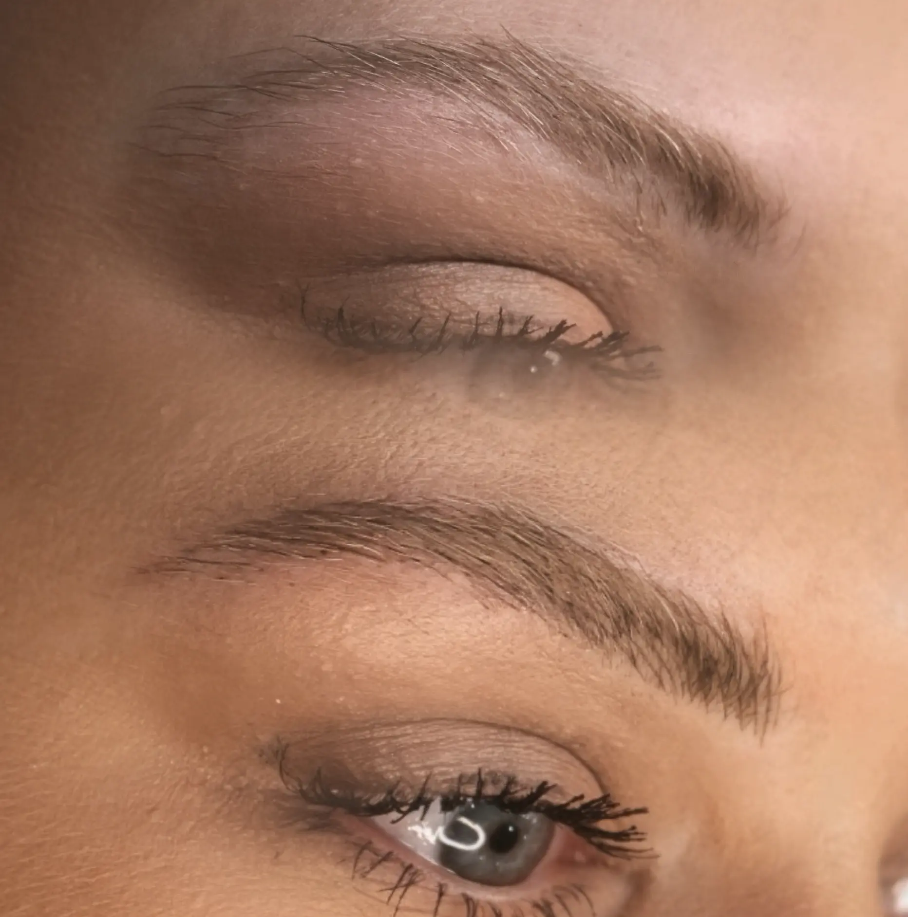eyebrow tattoo removal melbourne