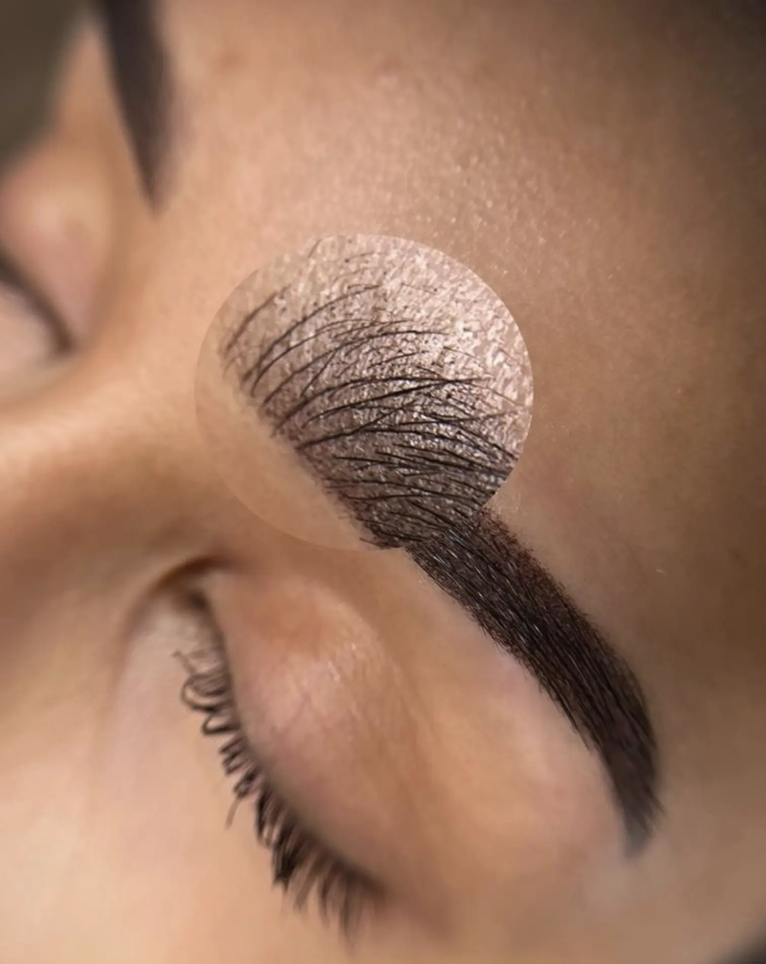 eyebrow tattoo removal sydney