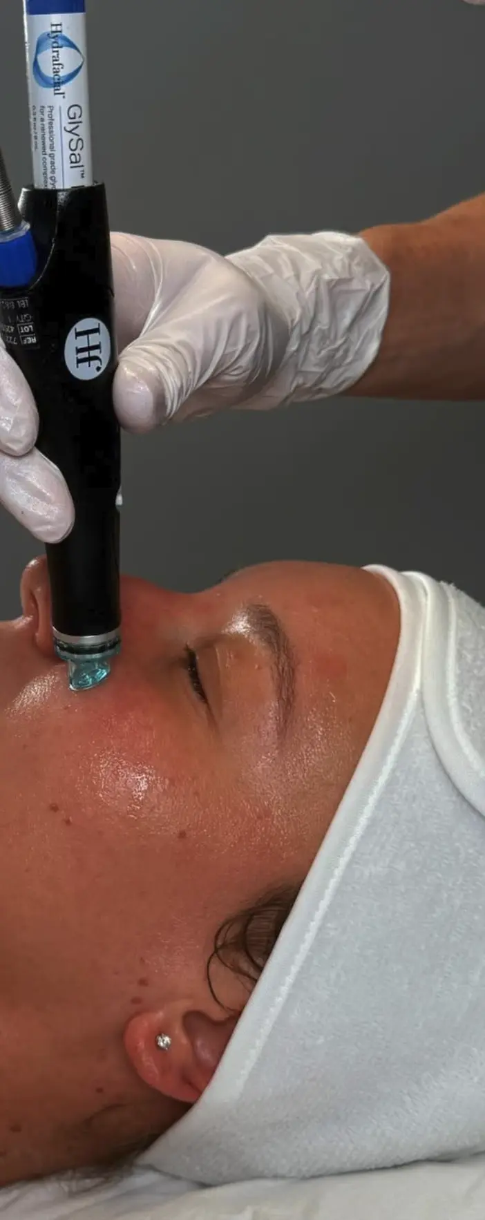 how many steps in hydrafacial