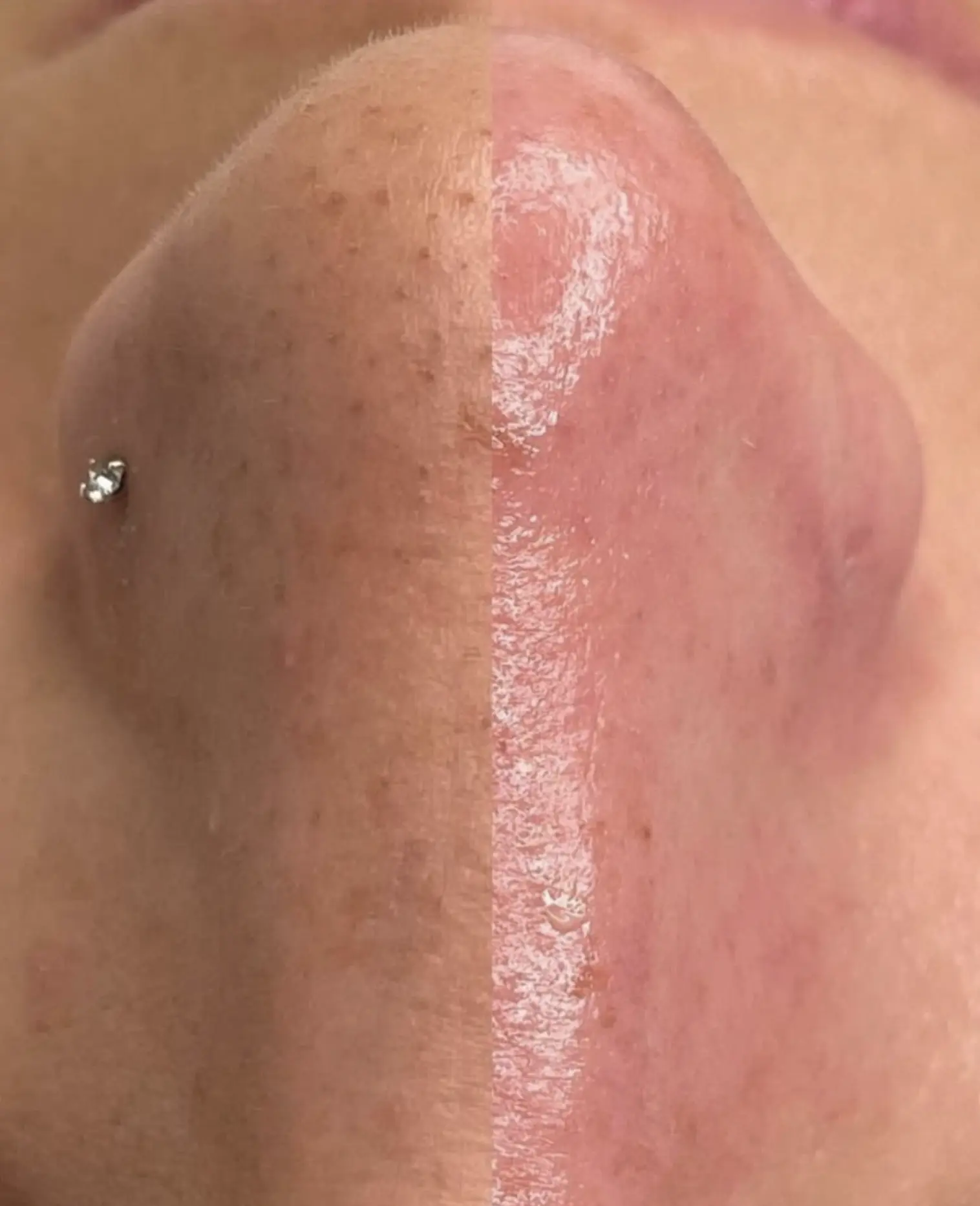 hydrafacial brisbane price